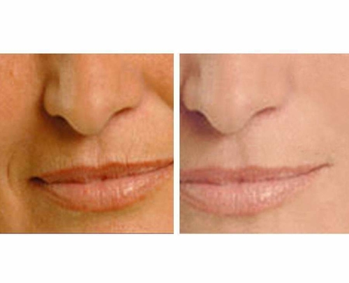 Age Perfect: Night Repair Cream + Vitamin C+ Serum - Image 6